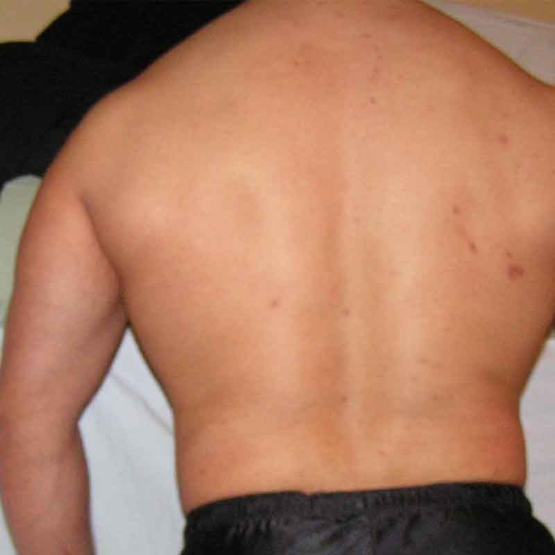 Does Taurine Help with Back Pumps?